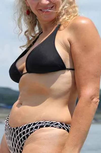 Linn Tønsberg